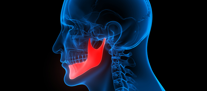 acidente maxilar e mandibula